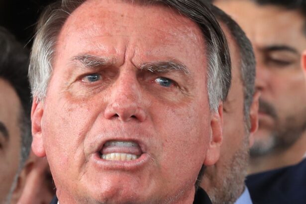 exames-de-bolsonaro-indicam-resquicios-de-inflamacoes-pulmonares