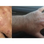 especialistas-alertam-para-a-falta-de-informacao-sobre-a-leishmaniose