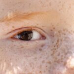 reflexo-branco-nos-olhos:-entenda-condicao-que-assusta-pais