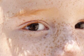 reflexo-branco-nos-olhos:-entenda-condicao-que-assusta-pais