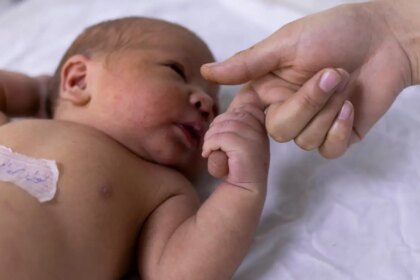 teste-do-olhinho-deve-ser-repetido-tres-vezes-ao-ano-ate-os-3-anos