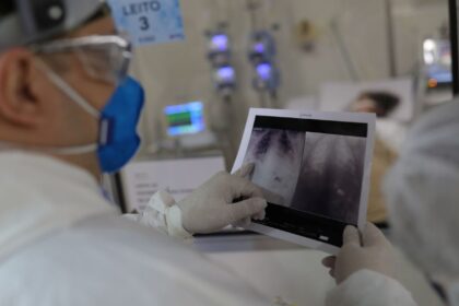 covid-e-principal-causa-de-internacao-por-sindrome-respiratoria-no-rio