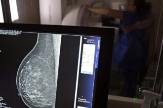 ministerio-da-saude-passa-a-recomendar-mamografia-a-partir-dos-40-anos