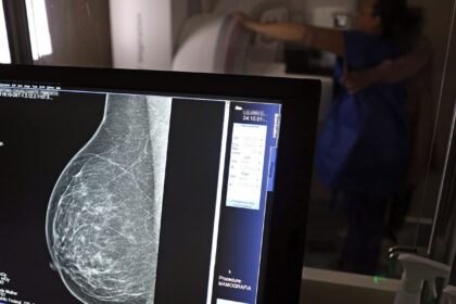 ministerio-da-saude-passa-a-recomendar-mamografia-a-partir-dos-40-anos
