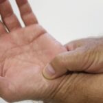 politica-para-pacientes-reumaticos-pode-criar-modelo-a-ser-replicado