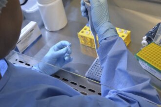 pais-tem-17-casos-confirmados-de-intoxicacao-por-metanol