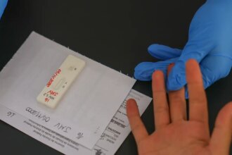 hiv/aids:-brasil-vai-insistir-em-acordo-por-prep-de-longa-duracao