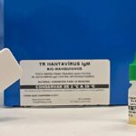novo-teste-faz-diagnostico-de-hantavirose-em-20-minutos