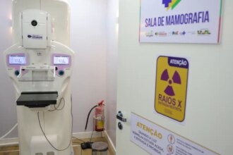 lei-garante-mamografia-pelo-sus-para-mulheres-a-partir-dos-40-anos