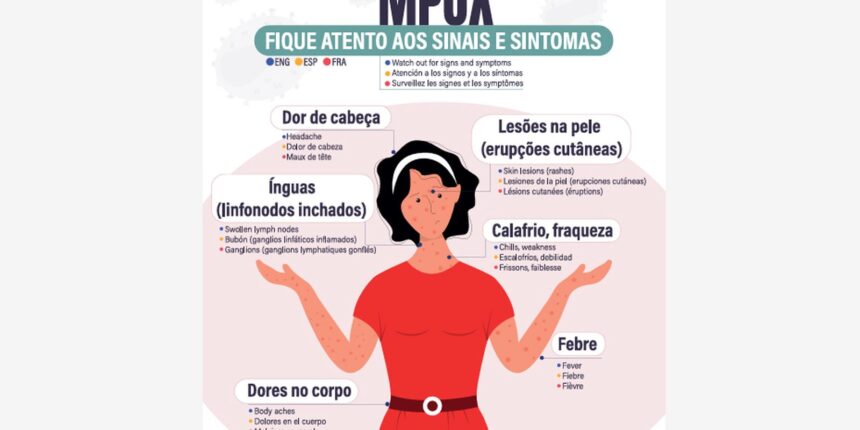 secretaria-de-saude-confirma-segundo-caso-de-mpox-do-grupo-lp-em-sp