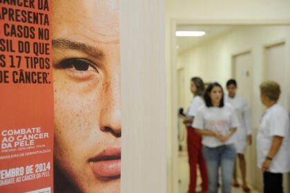 casos-de-cancer-de-pele-saltam-de-4-mil-para-mais-de-72-mil-em-10-anos