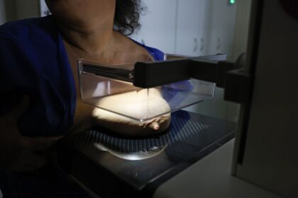 vigitel:-92%-das-brasileiras-entre-50-e-69-anos-fizeram-mamografia