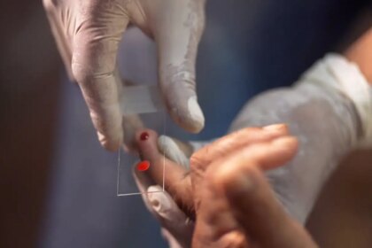 sus-comeca-a-usar-novo-tratamento-contra-a-malaria-em-criancas