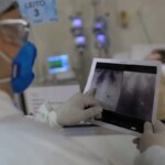 broncopneumonia:-entenda-quadro-que-causou-internacao-de-bolsonaro