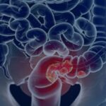 rastreamento-para-cancer-colorretal-pode-ser-implementado-no-sus