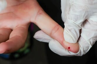 teste-rapido-de-dengue-passa-a-integrar-tabela-do-sus