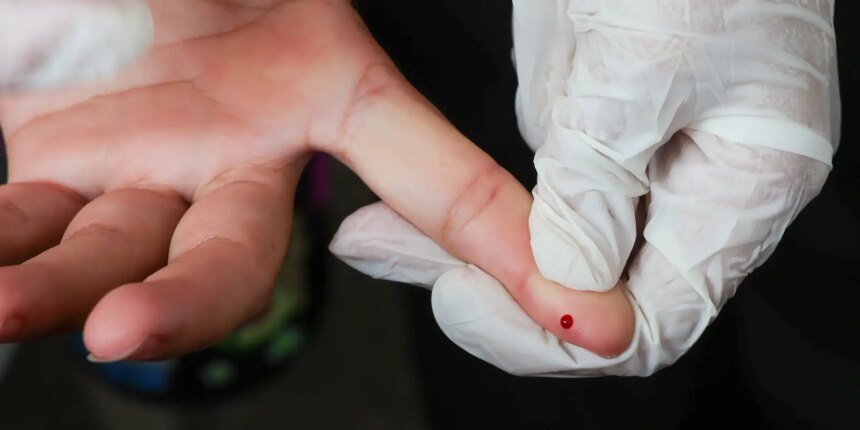 teste-rapido-de-dengue-passa-a-integrar-tabela-do-sus