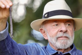 lula-vai-a-sp-para-tirar-excesso-de-pele-na-cabeca-e-tratar-tendinite